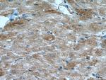 BMPR2 Antibody in Immunohistochemistry (Paraffin) (IHC (P))