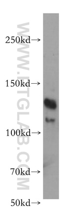 BMPR2 Antibody in Western Blot (WB)