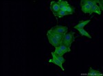 ACTN4 Antibody in Immunocytochemistry (ICC/IF)