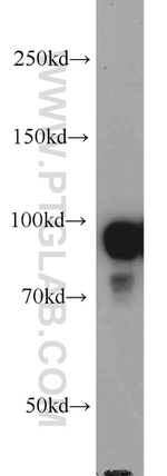 ACTN4 Antibody in Western Blot (WB)
