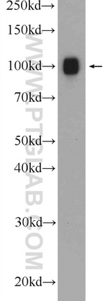 ACTN4 Antibody in Western Blot (WB)