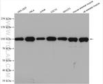 ACTN4 Antibody in Western Blot (WB)