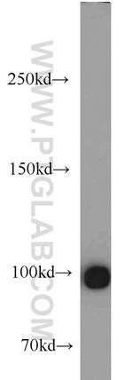 ACTN4 Antibody in Western Blot (WB)