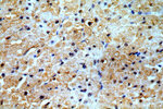 PRICKLE3 Antibody in Immunohistochemistry (Paraffin) (IHC (P))