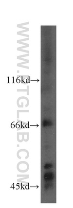 PRICKLE3 Antibody in Western Blot (WB)