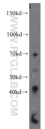 PRICKLE3 Antibody in Western Blot (WB)