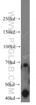 PRICKLE3 Antibody in Western Blot (WB)