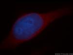 CYP2S1 Antibody in Immunocytochemistry (ICC/IF)