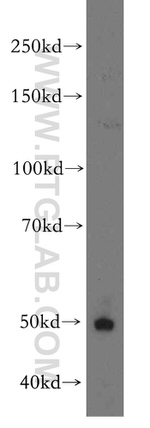 CYP2S1 Antibody in Western Blot (WB)