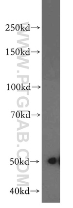 CYP2S1 Antibody in Western Blot (WB)