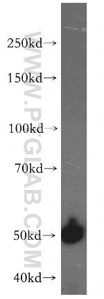 CYP2S1 Antibody in Western Blot (WB)