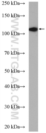 EPAC2 Antibody in Western Blot (WB)