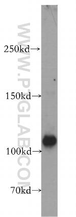 EPAC2 Antibody in Western Blot (WB)