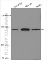 ALPK1 Antibody in Western Blot (WB)