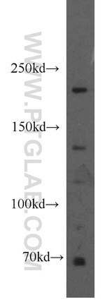ALPK1 Antibody in Western Blot (WB)