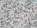 CDK6 Antibody in Immunohistochemistry (Paraffin) (IHC (P))