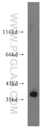 CDK6 Antibody in Western Blot (WB)