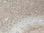 FOXO6 Antibody in Immunohistochemistry (Paraffin) (IHC (P))