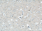 FOXO6 Antibody in Immunohistochemistry (Paraffin) (IHC (P))
