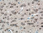 FOXO6 Antibody in Immunohistochemistry (Paraffin) (IHC (P))
