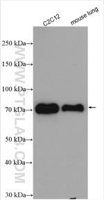 FOXO6 Antibody in Western Blot (WB)