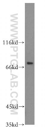 FOXO6 Antibody in Western Blot (WB)
