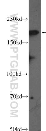 DCC Antibody in Western Blot (WB)