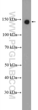 Calcium Sensing Receptor Antibody in Western Blot (WB)