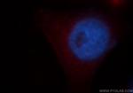 VPS11 Antibody in Immunocytochemistry (ICC/IF)