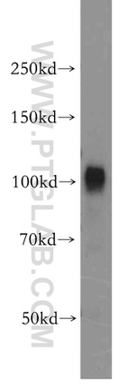 VPS11 Antibody in Western Blot (WB)