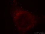 PLCH1 Antibody in Immunocytochemistry (ICC/IF)