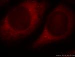 PLCH1 Antibody in Immunocytochemistry (ICC/IF)