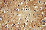 PLCH1 Antibody in Immunohistochemistry (Paraffin) (IHC (P))