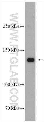 RFC1 Antibody in Western Blot (WB)