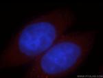 FKBP6 Antibody in Immunocytochemistry (ICC/IF)