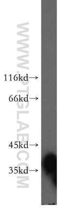 FKBP6 Antibody in Western Blot (WB)