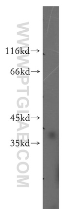 FKBP6 Antibody in Western Blot (WB)