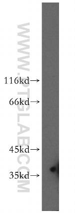 FKBP6 Antibody in Western Blot (WB)