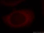 RAP1GAP Antibody in Immunocytochemistry (ICC/IF)