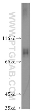 RAP1GAP Antibody in Western Blot (WB)