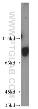 RAP1GAP Antibody in Western Blot (WB)