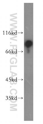 RAP1GAP Antibody in Western Blot (WB)