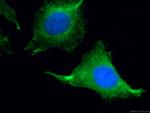PSMB5 Antibody in Immunocytochemistry (ICC/IF)