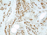 PSMB5 Antibody in Immunohistochemistry (Paraffin) (IHC (P))