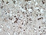 PSMB5 Antibody in Immunohistochemistry (Paraffin) (IHC (P))