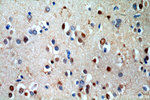 RUFY2 Antibody in Immunohistochemistry (Paraffin) (IHC (P))