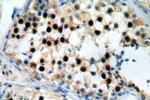 RUFY2 Antibody in Immunohistochemistry (Paraffin) (IHC (P))