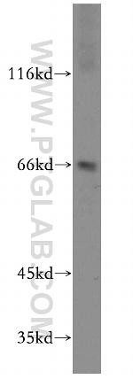 RUFY2 Antibody in Western Blot (WB)