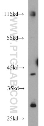 FANCL Antibody in Western Blot (WB)