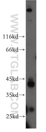 FANCL Antibody in Western Blot (WB)